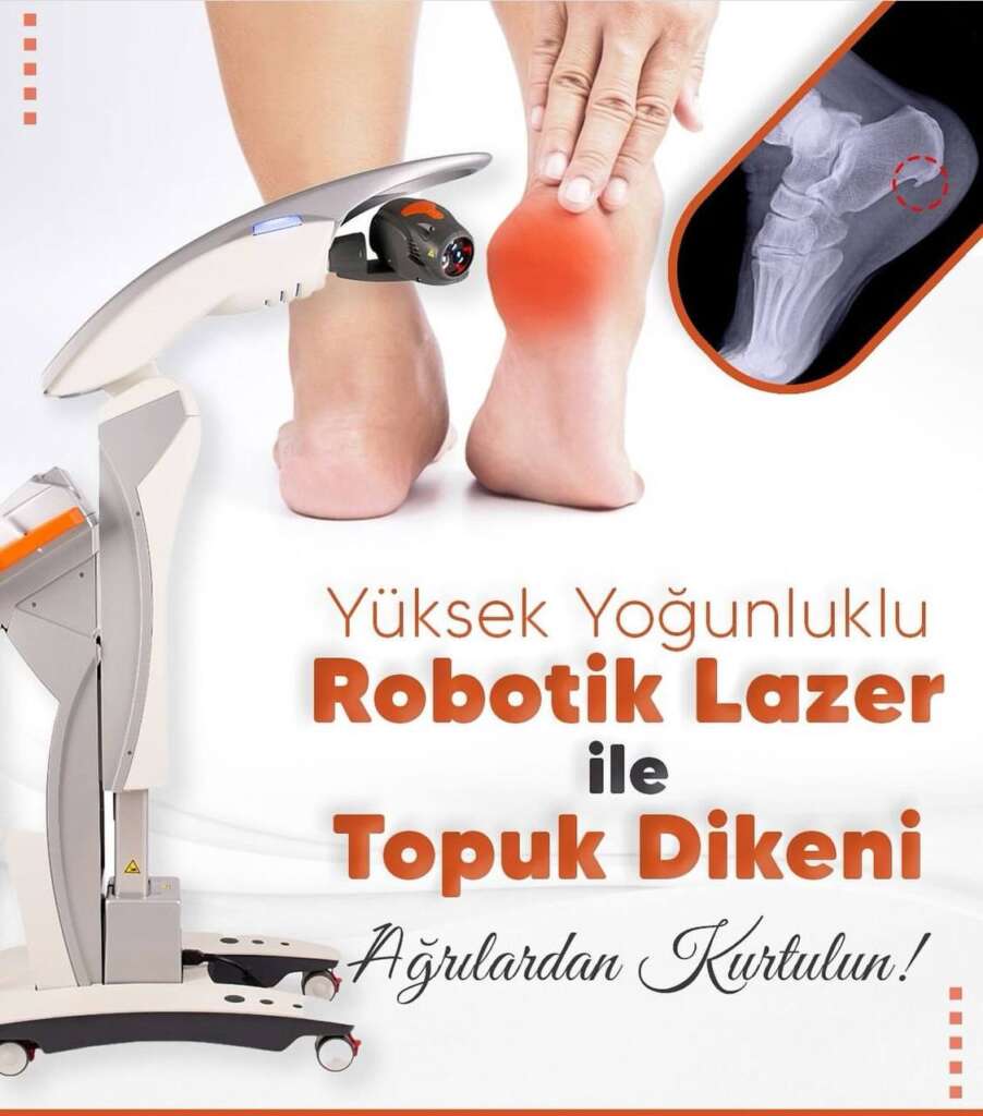 Topuk Dikeni Tedavisi